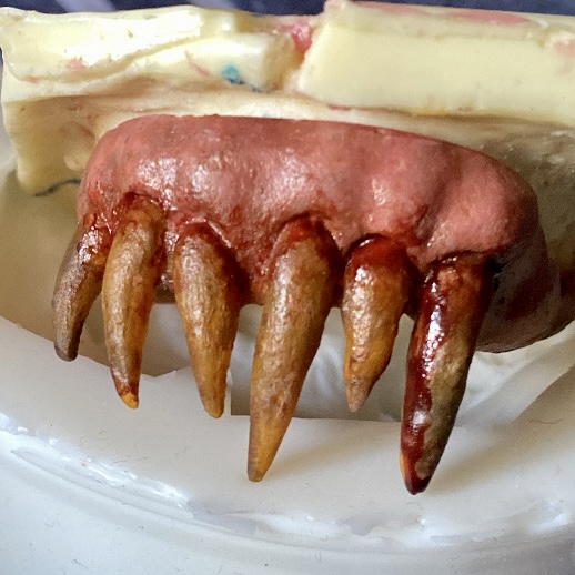 Prótesis dental